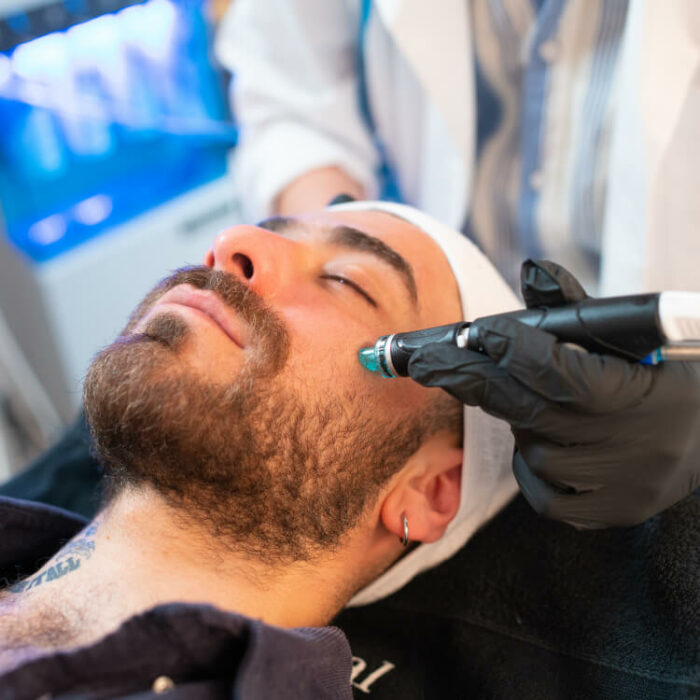 Tratamiento hydrafacial barcelona